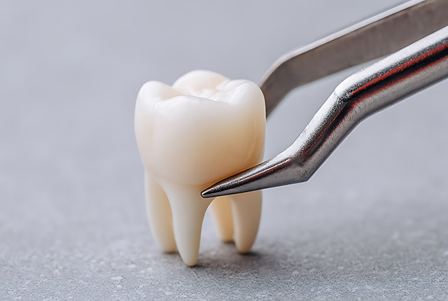 親知らずの抜歯