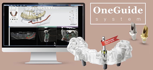OneGuide system シミュレーション